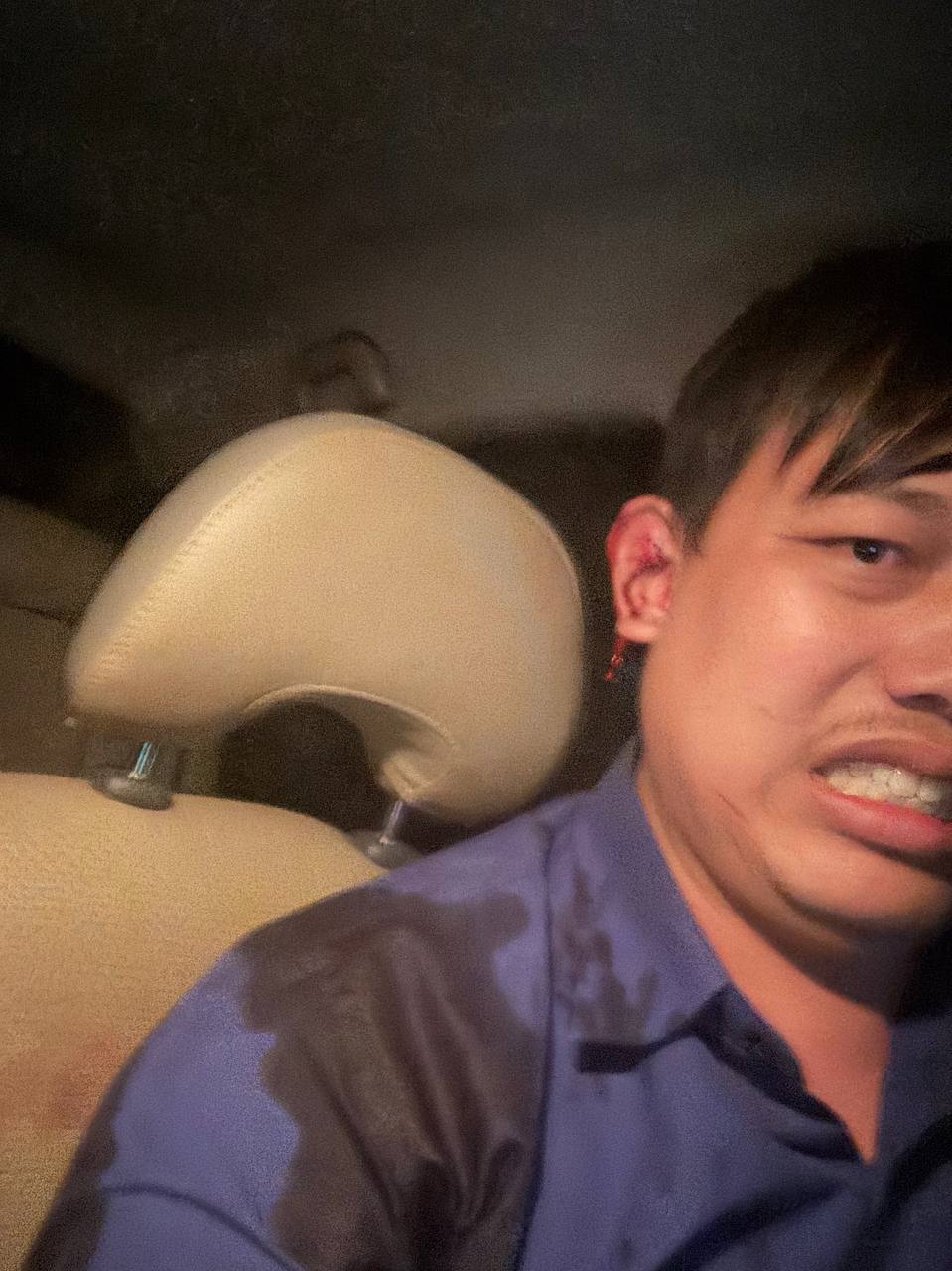 不是中国劫匪抢劫！而是10美元车费引发血案！